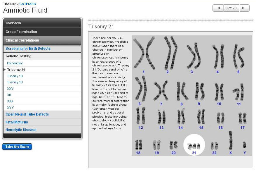 Genetic testing - Trisomy 21