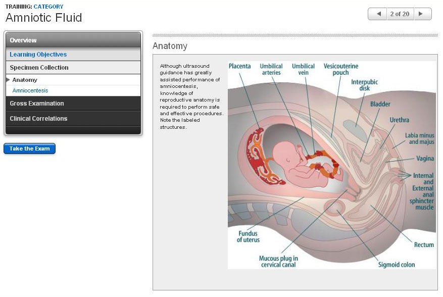 Specimen Collection - Amniotic Fluid