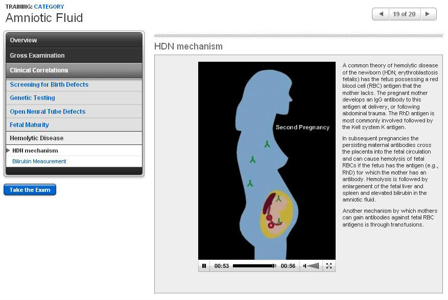 HDN Mechanism