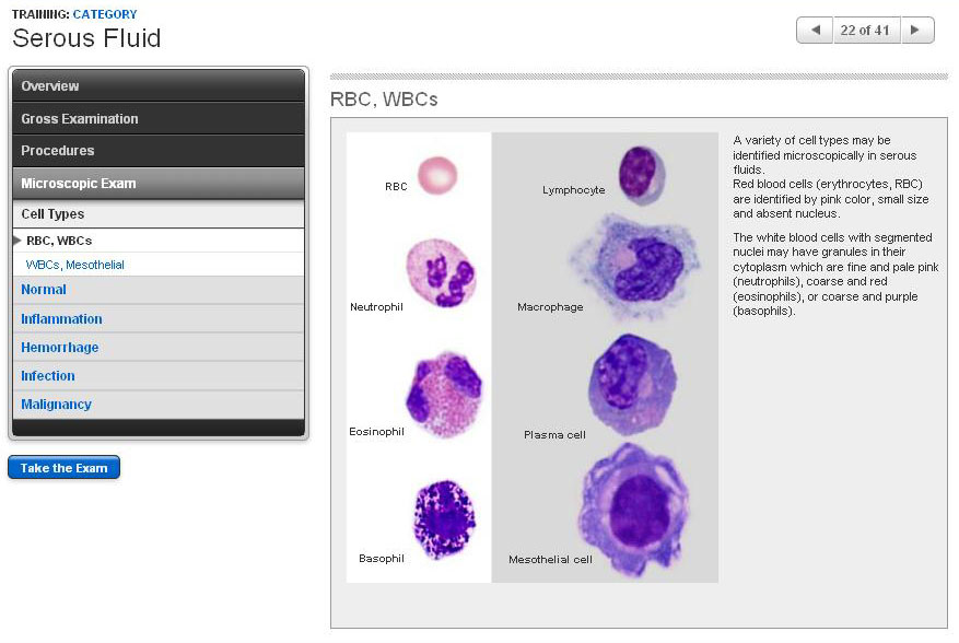 Microscopic Examination - RBC, and WBCs