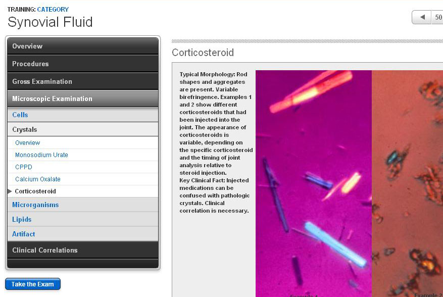 Microscopic Examination Corticosteroid