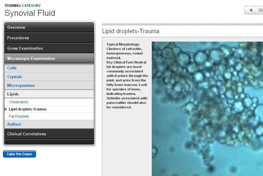 Lipid Droplets - Trauma