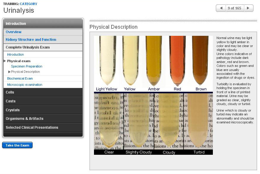 Physical Description of Urine