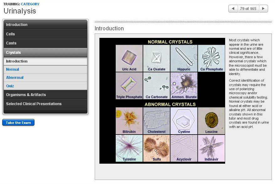 Normal and Abnormal Urine Crystals