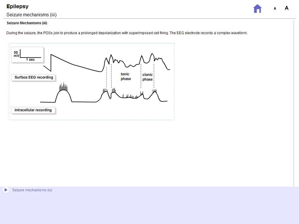 EEG electrode records