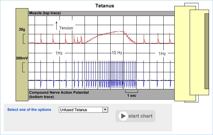 Unfused Tetanus