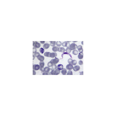 Trypanosoma protozoa in blood