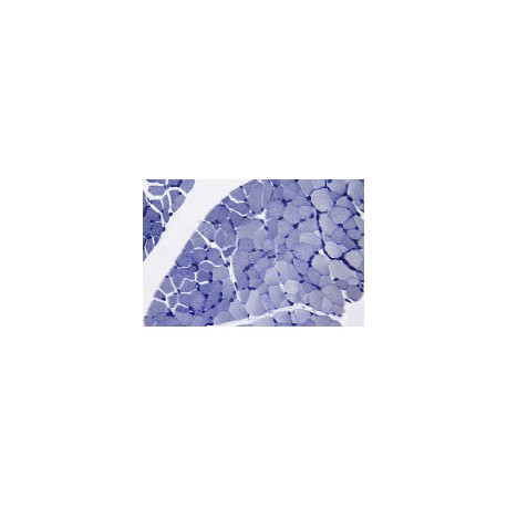 Skeletal muscle of cat, t.s., showing muscle nuclei 