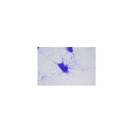 Neurocyte, showing dendrites and glia cells