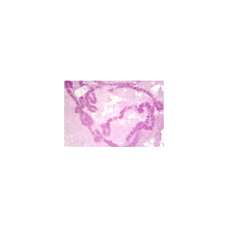 Salivary chromosome of drosophila w.m.