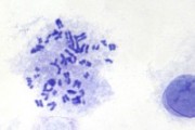 Chromosome of normal man, showing metaphase spread