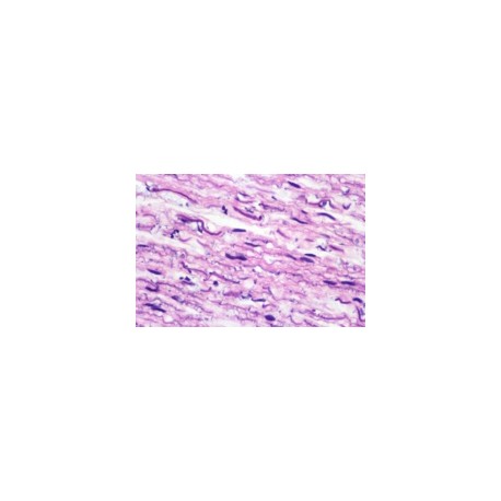 Human fibroblast
