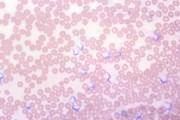 Trypanosoma gambiense, a blood flagellate, causing Central African sleeping disease, blood smear