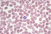Human blood, smear GS stain