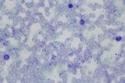 Babesia canis, blood smear shows heavy infection