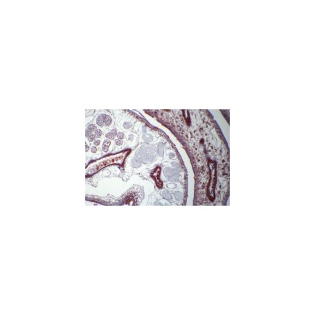 Fasciola hepatica in bile ducts of liver, t.s.