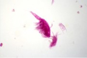Mixed plankton, strewn slide No. II