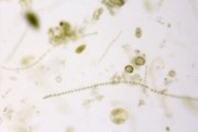 Mixed plankton, strewn slide No. III