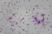 Bacillus thuringiensis smear