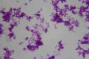 Agrobacterium tumefaciens smear