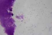 Escherichia coli, gram negative, smear slide