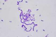 Bacillus megaterium, smear