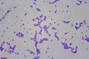 Diplococcus pneumoniae, smear