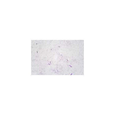 Nitrobacter smear