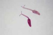 Cercaria of Schistosoma japonicum w.m.