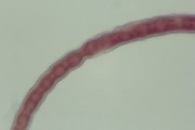 Trichinella spiralis male, w.m.