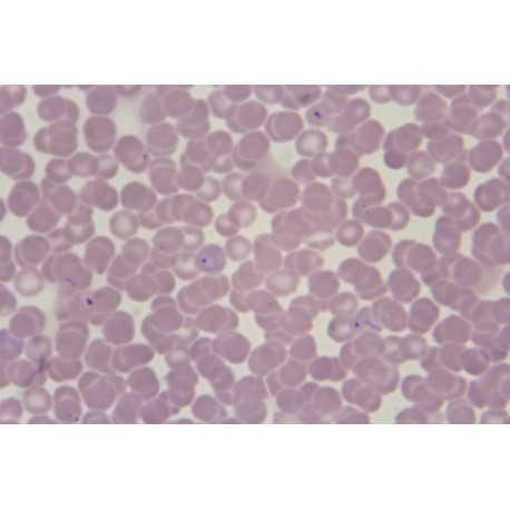 Plasmodium vivax ring stages, blood smear