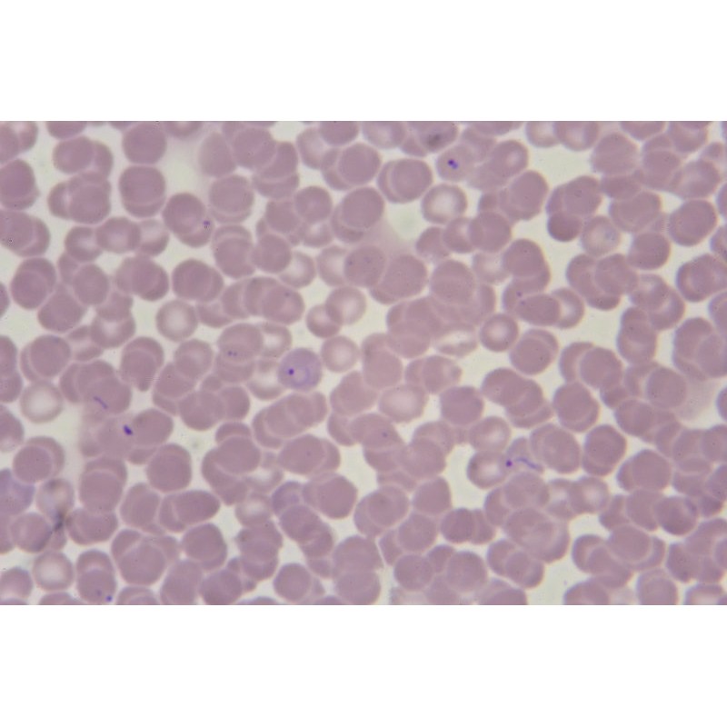Malarial parasite:- Part 4 - Plasmodium Malariae, Benign Quartan Malaria -  Labpedia.net