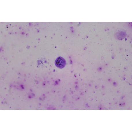 Leishmania donovani promastigotes , smear (agent of visceral ) *