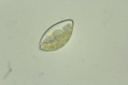 Schistosoma mansoni eggs, w.m.