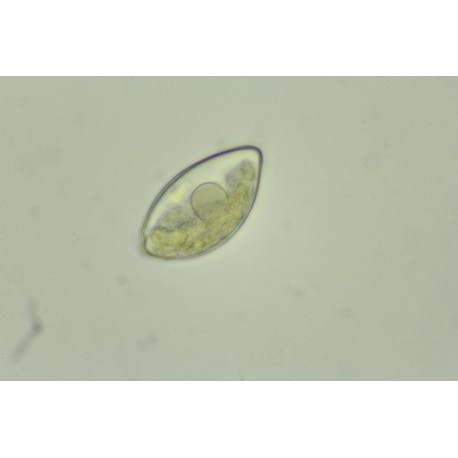 Schistosoma mansoni eggs, w.m.