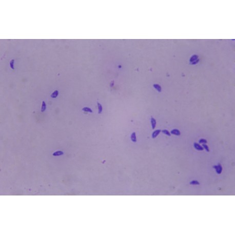 Toxoplasma gondii, causing toxoplasmosis, tissue smear with parasites