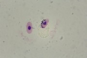 Haemoproteus columbae, pigeon malaria, blood smear *