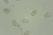 Eggs of Clonorchis sinensis w.m. (natural color)