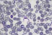 Blood trypanosome smear