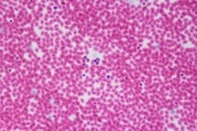 Blood of pigeon smear