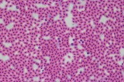 Blood of fish smear