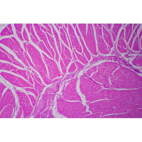 Stratified, non-cornified squamous epithelium, section of oesophagus