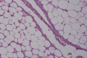 Adipose tissue, human, sec. fat removed to show the cells