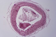 Artery, human, t.s. stained for elastic fibres