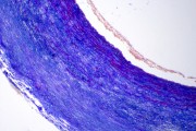 Aorta, human, t.s. routine stained