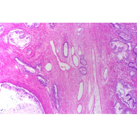 Prostate of young man, t.s.