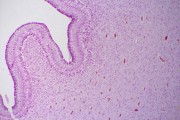 Cerebellum from human foetus, t.s. routine stained