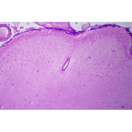 Cerebrum and cerebellum composite slide, human, t.s. routine stained