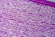 Spinal cord, human, l.s. routine stained