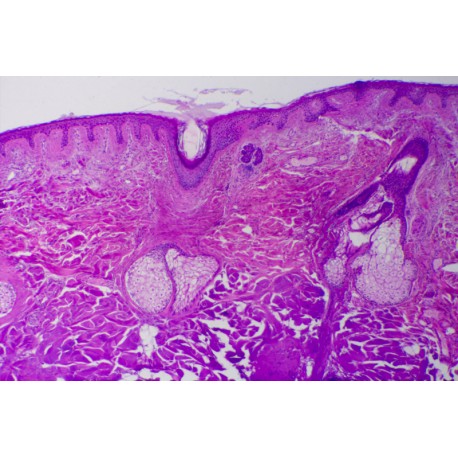 Scalp, vertical l.s. shows l.s. of hair follicles, human
